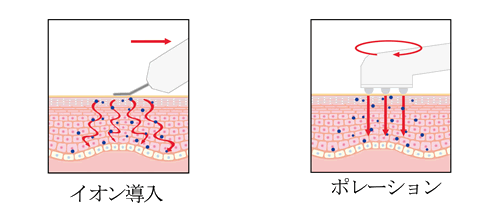 �C�I�������|���[�V����