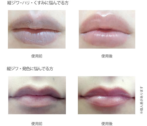 ���b�v�G�X�e�r�t�H�[�A�t�^�[